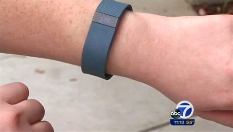 Users Complain Of Rashes From Fitbit Charge Told To Air Out Their