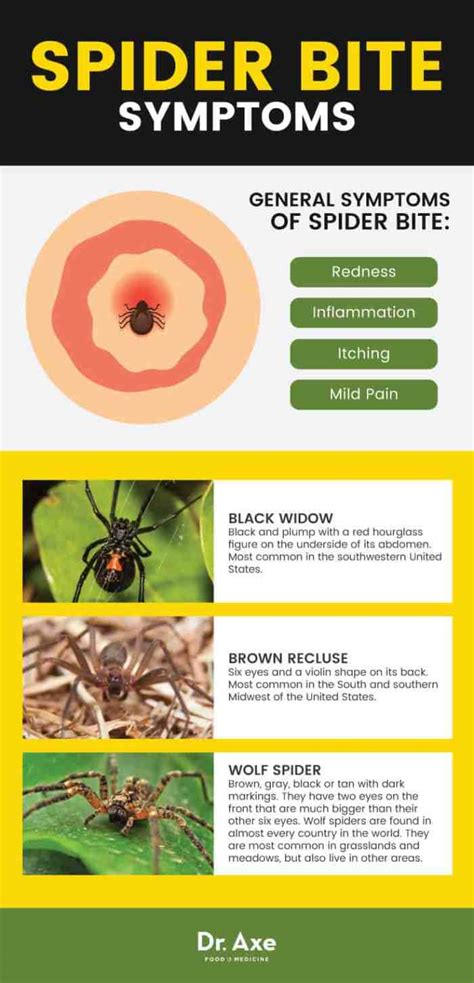 Spider Bite Symptoms 6 Easy Natural Treatments The Mad Truther