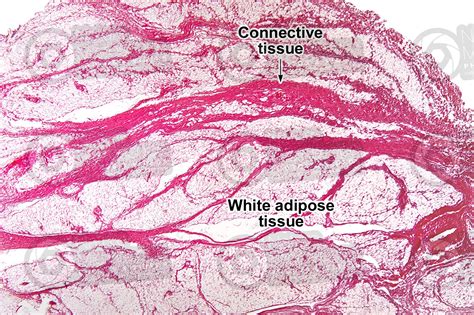 Mammal Unilocular Adipose Tissue Transverse Section 32x Unilocular