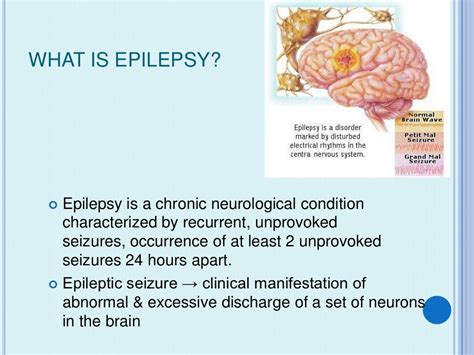 What Is Epilepsy Epilepsy