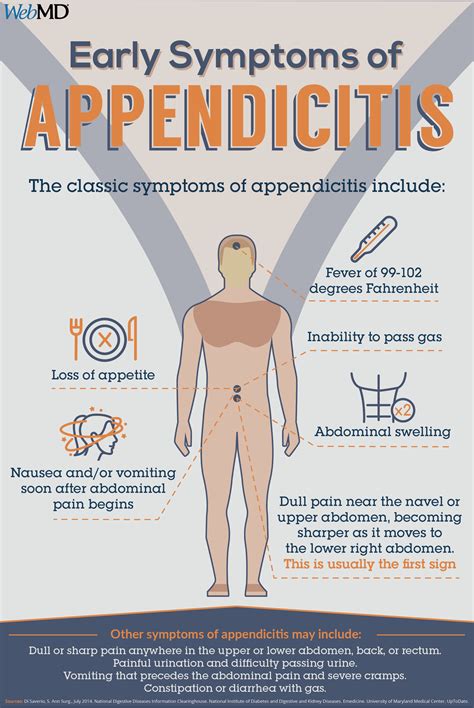 Appendicitis Artofit