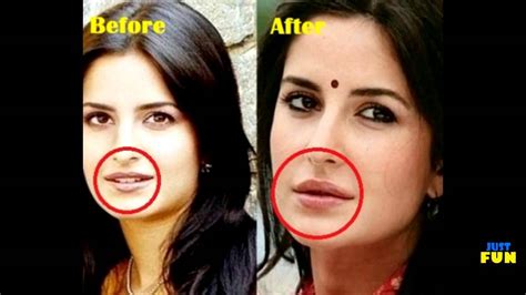 bollywood celebrities before and after plastic surgery compilation hd youtube