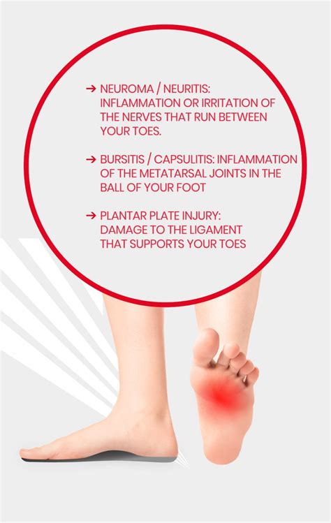 Relieve Ball Of Foot Pain Fast Get Expert Treatment With Prescription