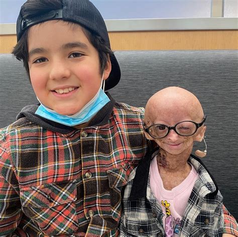 Youtube Star Adalia Rose Passes Away At 15 After Life With Rare Genetic Condition
