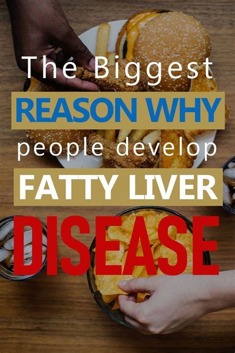 Pin on Fatty liver Symptoms Tips Blog