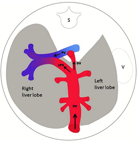 Fetal Umbilical Portal System Venous Shunts
