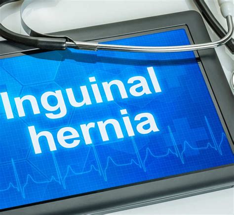Inguinal Hernia Top Oc Surgery Center Crown Valley Surgical
