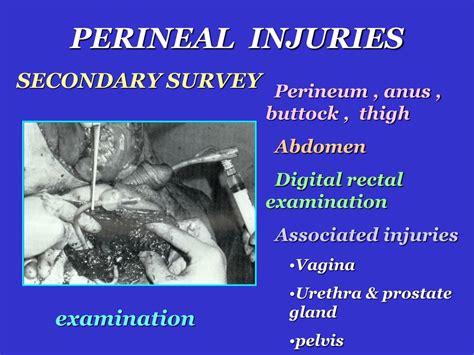 Ppt Colon Rectum Injuries Powerpoint Presentation Free Download Id