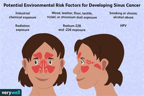Sinus Cancer Causes And Risk Factors
