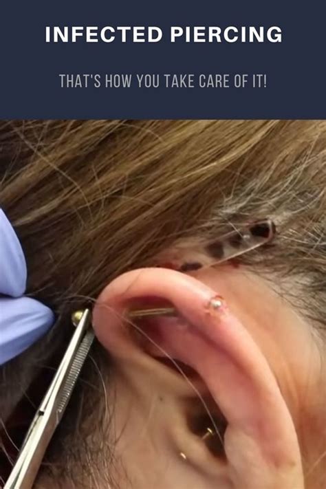 Infected Piercing Thats How You Take Care Of It Ear Piercing Care New Ear Piercing