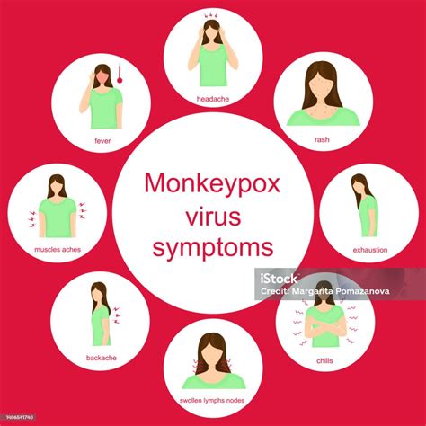 Gejala Virus Monkeypox Dan Tandatanda Ilustrasi Vektor Infografis