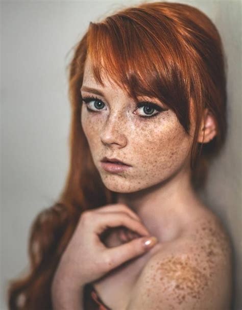 Pin By Ray On Crimson And Clover Beautiful Freckles Freckles Girl