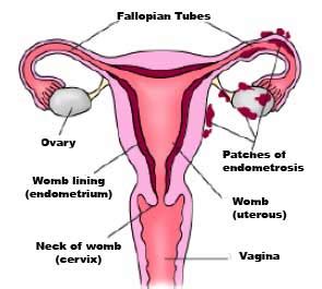 Journal of assisted reproduction and genetics. Endometriosis Awareness Week 2021 - 3rd March to 9th March