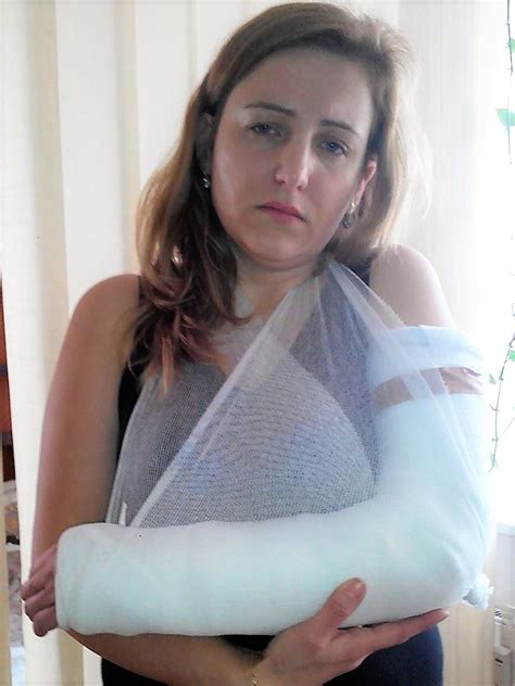 Girl In An Arm Cast Tumblr Gallery