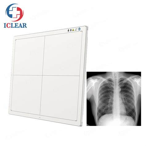 Iray 17x17 Wireless Wired Digital Radiography X Ray Flat Panel Detector