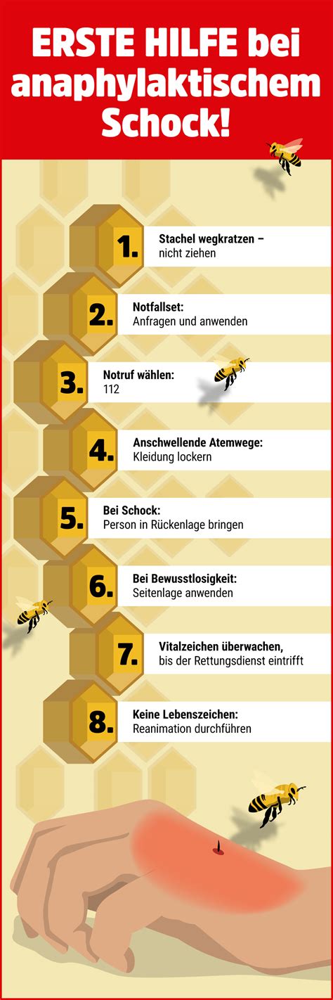 Was Macht Man Bei Einem Bienenstich Captions Trend Today