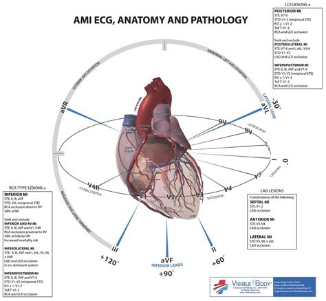 MI Localization LITFL ECG Anatomy Basics
