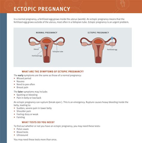 Reproductive Health Access Project Treating Ectopic Pregnancy In