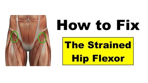 The hip flexors are the muscles located on the front of the hip, just above the thighs. Fixing Hip Flexor Pain - Squat University