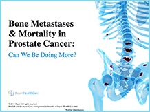 Treating Prostate Cancer Bone Metastasis Battle In The Bone
