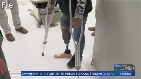 Ua Gets 49 Million Grant For Prosthetics Clinical Trial Youtube