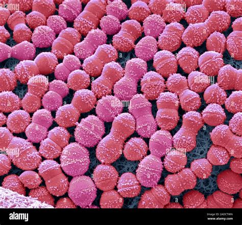 Streptococcus Mutans Color Análisis Micrografía De Electrones Sem S