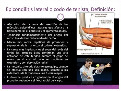 Epicondilitis Medial Y Lateral Fisioterapia