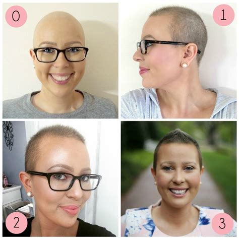 Hair Growth Styling Tips For Short Hair After Chemo