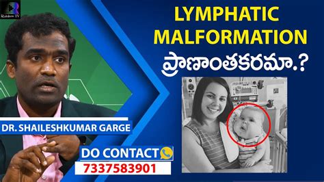 Lymphatic Malformation Causes Symptoms And New Treatment By Dr