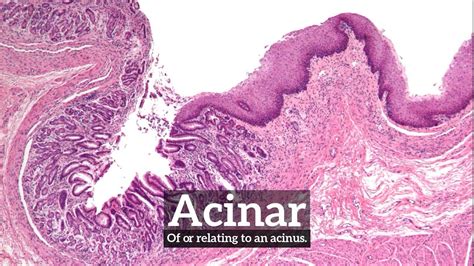 How To Say Acinar In English What Is Acinar How Does Acinar Look