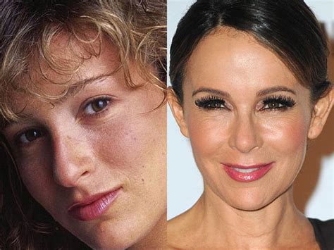 Jennifer Grey Celebrity Plastic Surgery Disasters Pictures Cbs News