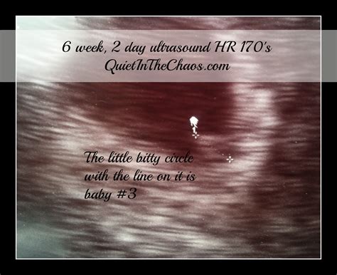Miscarriage is the loss of a pregnancy in the first 20 weeks. Pregnancy #3 Update: Beginning of Second Trimester - Quiet ...