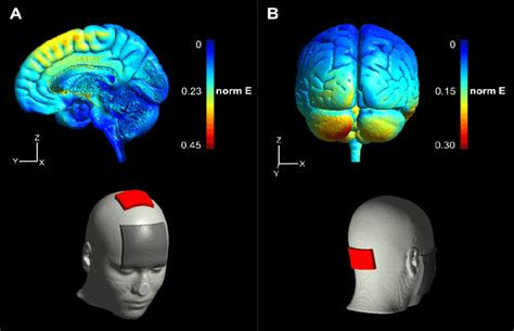Transcranial Direct Current Stimulation Tdcs Current Flow Simulation
