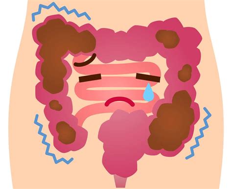 Guide De La Constipation Types Causes Complications Et Traitement