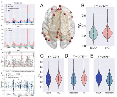 Reduced Default Mode Network Functional Connectivity In Patients With