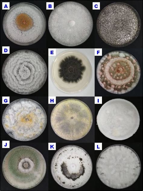 Macroscopic View Of Representatives Fungal Endophyte Inhabiting