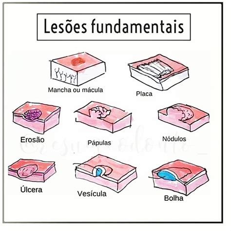 Lesoes Fundamentais Patologia Oral