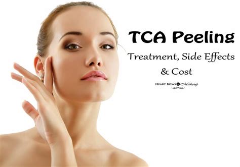 Tca Peeling Treatment Details Benefits Precautions And Side Effects