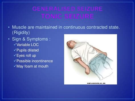 Approach To Seizure Cme