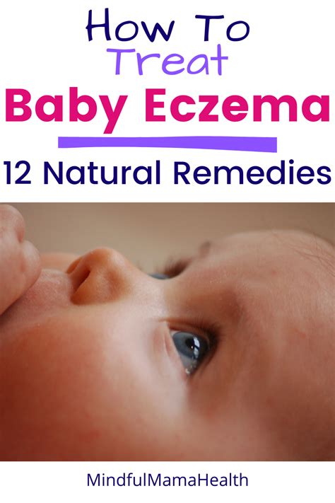 Safe And Effective Baby Eczema Natural Remedies Mindful Mama Health