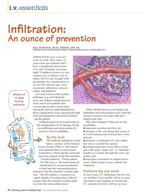 Iv Infiltration Intravenous Therapy Medicine