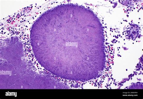 Bacteria In Tonsil Light Micrograph Stock Photo Alamy