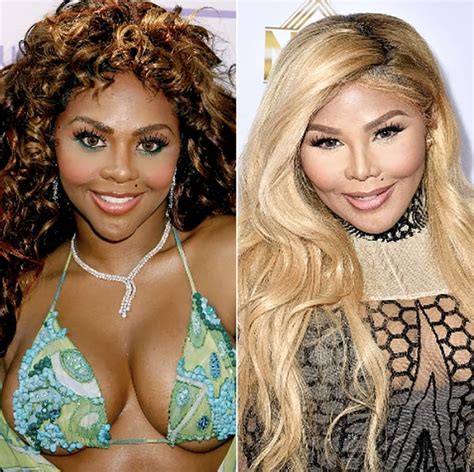 Top 10 Botched Plastic Surgery Fails Plastic Surgery Before And Vrogue