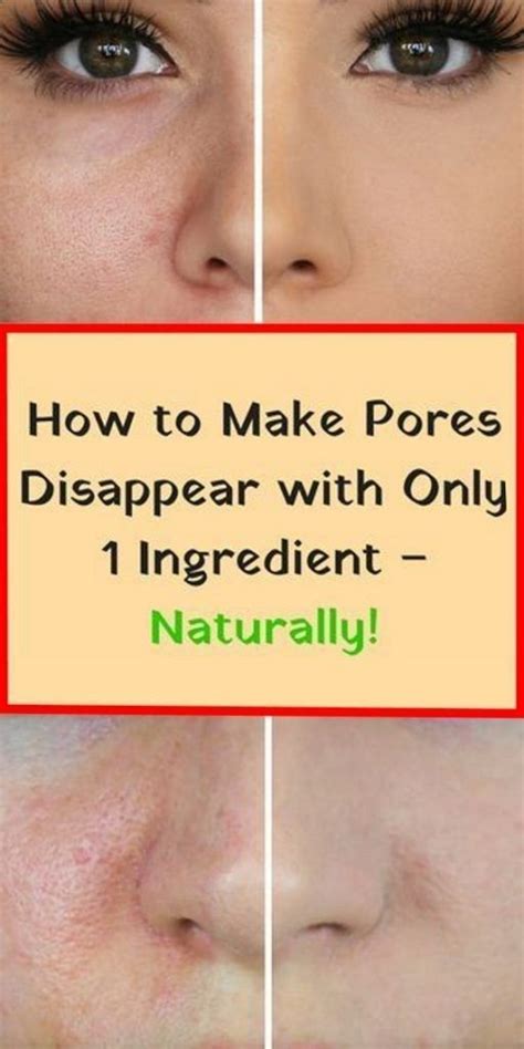How To Make Pores Disappear With Only 1 Ingredient Naturally