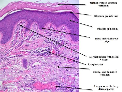 Histologic Diagram Of Skin High Magnification Histology Slides Skin