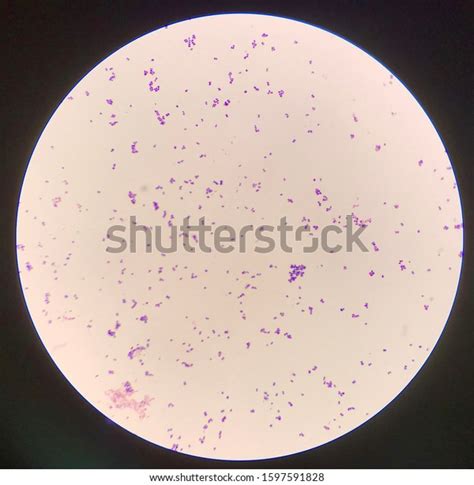 Bacteria Cell Gram Positive Cocci Stock Photo Edit Now 1597591828