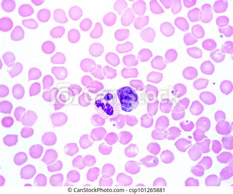 Human Blood Smear Neutrophil And Monocyte Human Blood Smear Showing A