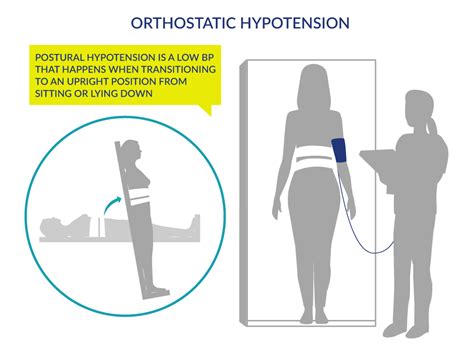 Orthostatic Hypotension Postural Hypotension Scire Community