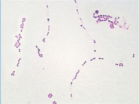 Gram Positive Cocci In Chains Group A Strep Gram Positive Cocci