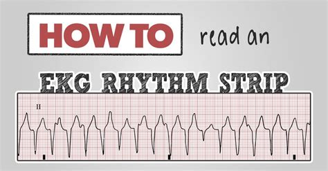 How To Read An Ekg Rhythm Strip